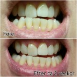 Recension: Curaprox tandkräm med aktiv kol